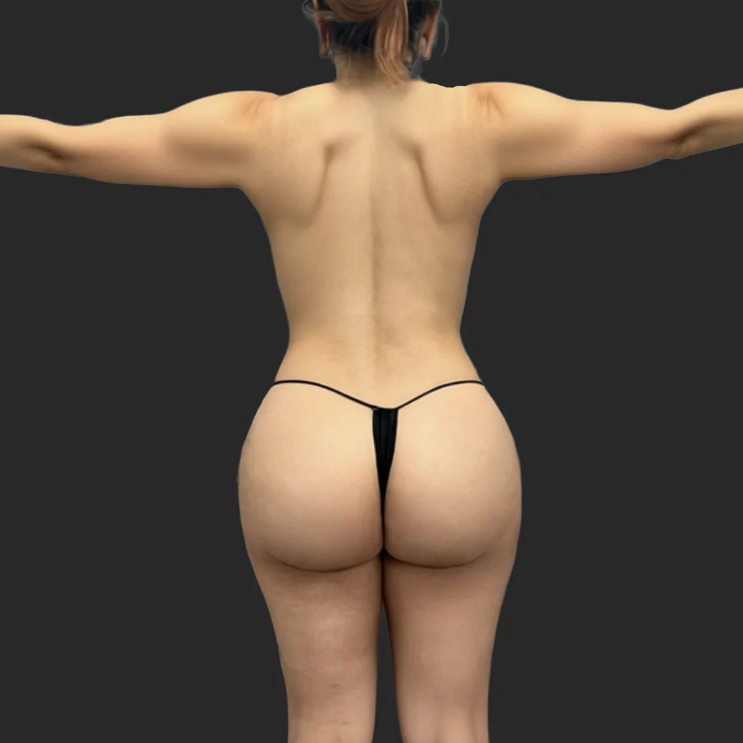 Procedure before and after - after