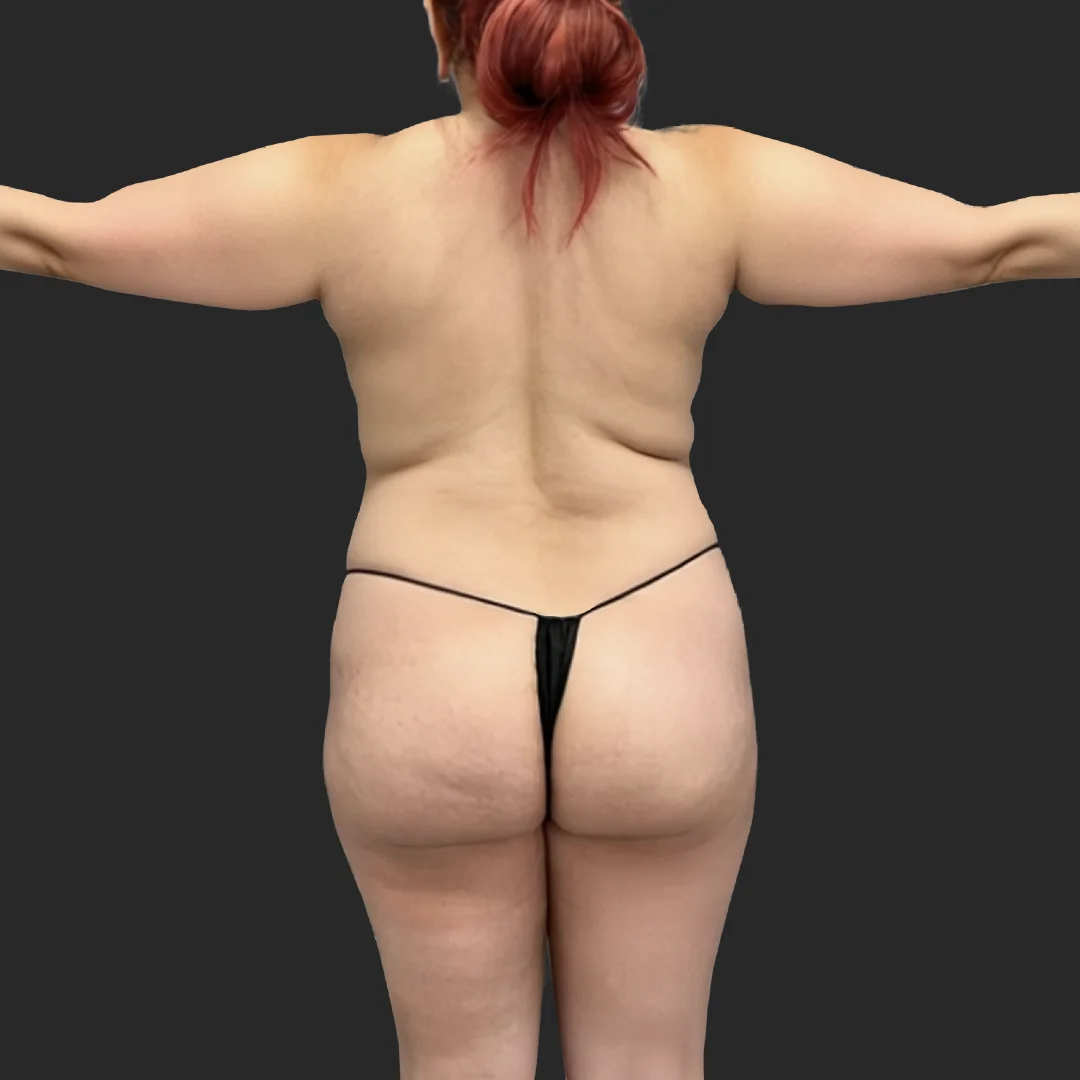 Procedure before and after - before