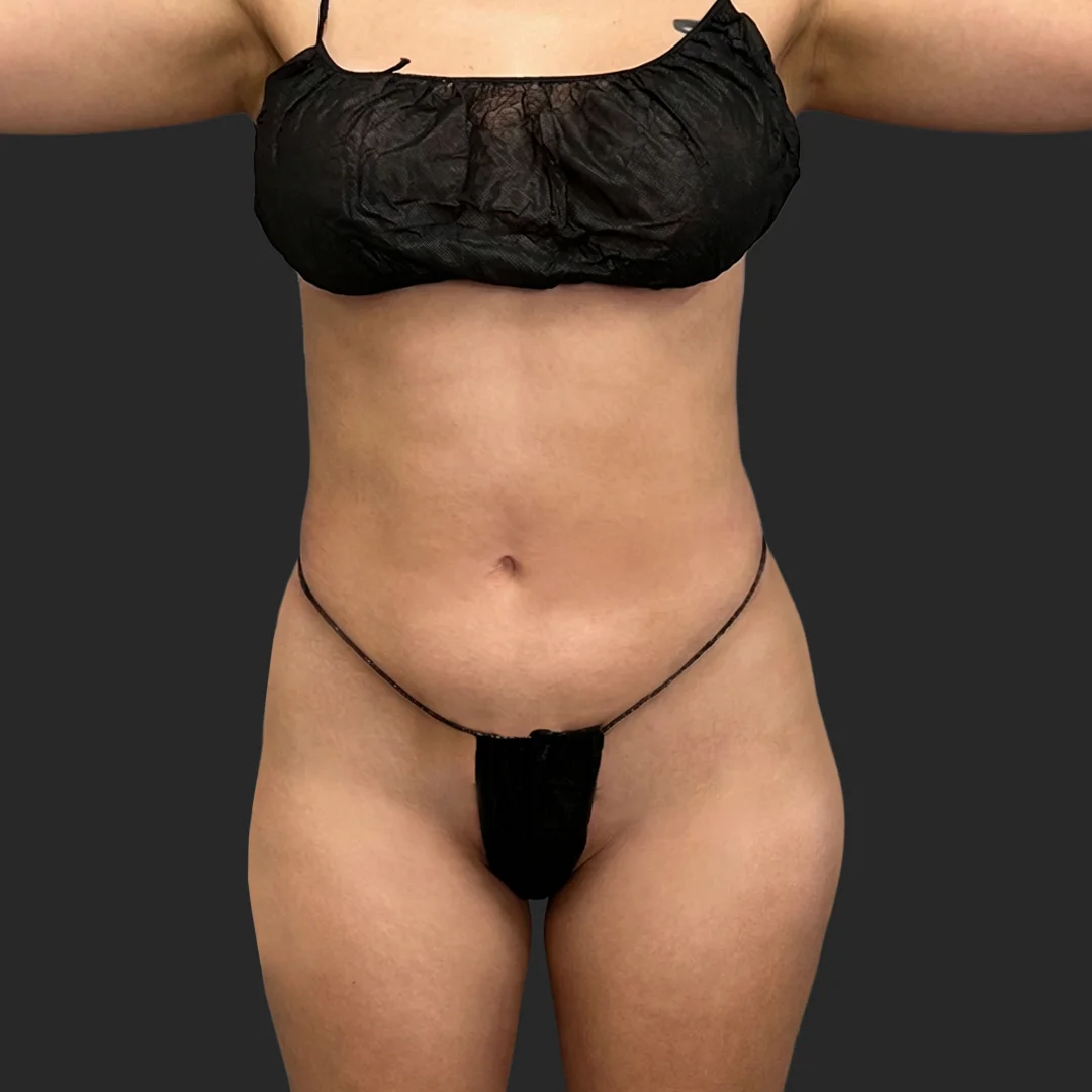 Procedure before and after - before