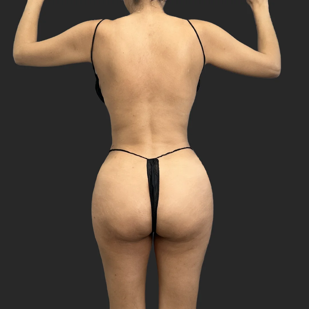 Procedure before and after - after