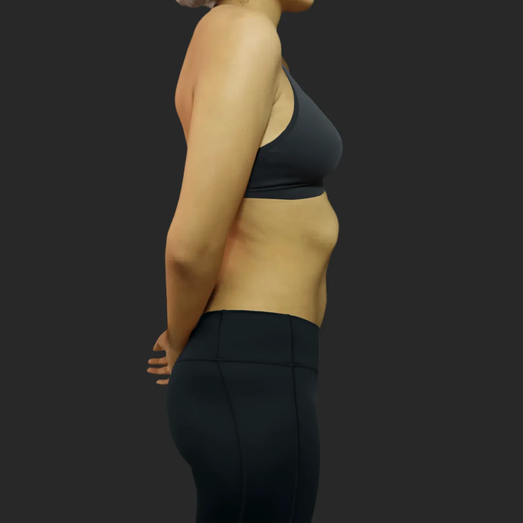 Procedure before and after - before