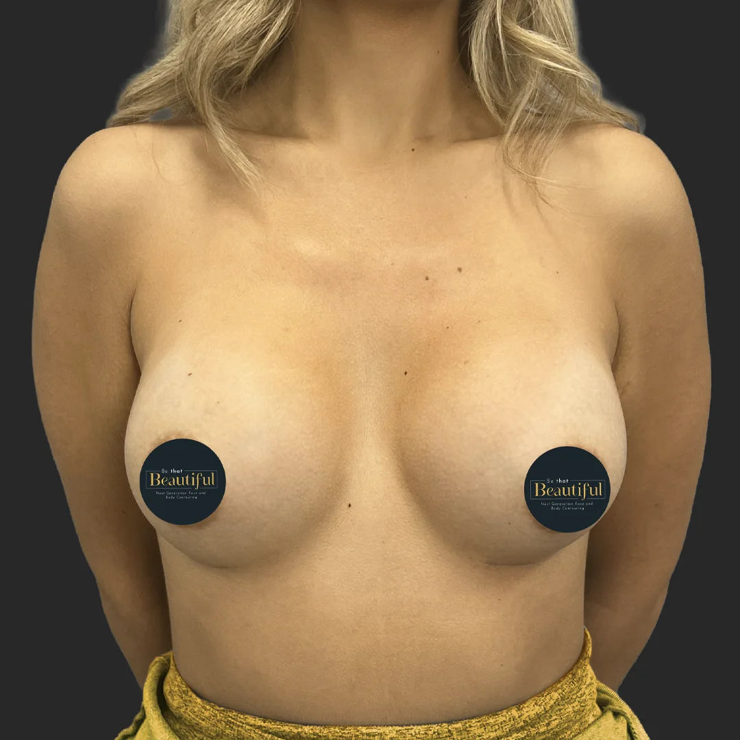 Procedure before and after - after