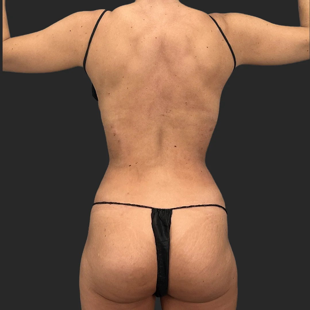 Procedure before and after - after