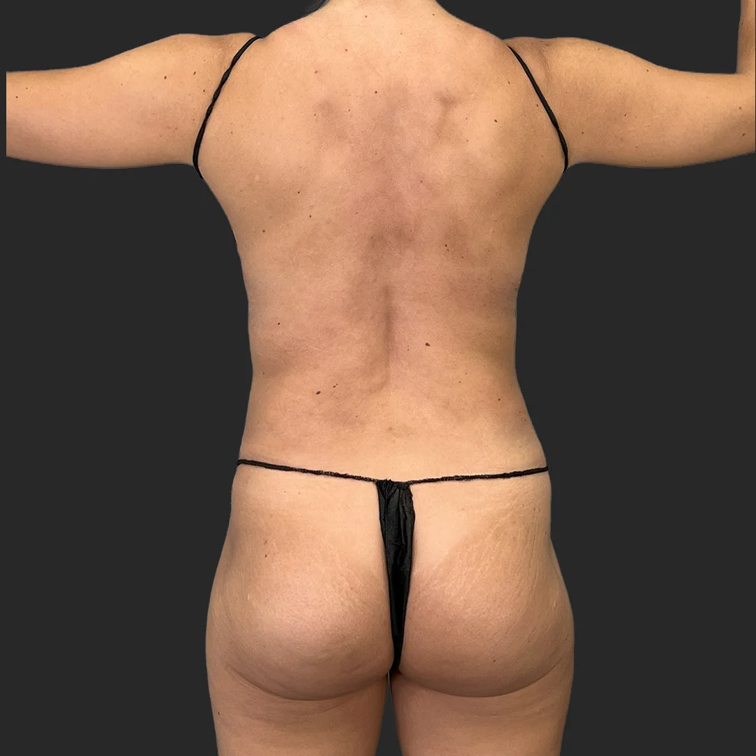 Procedure before and after - before