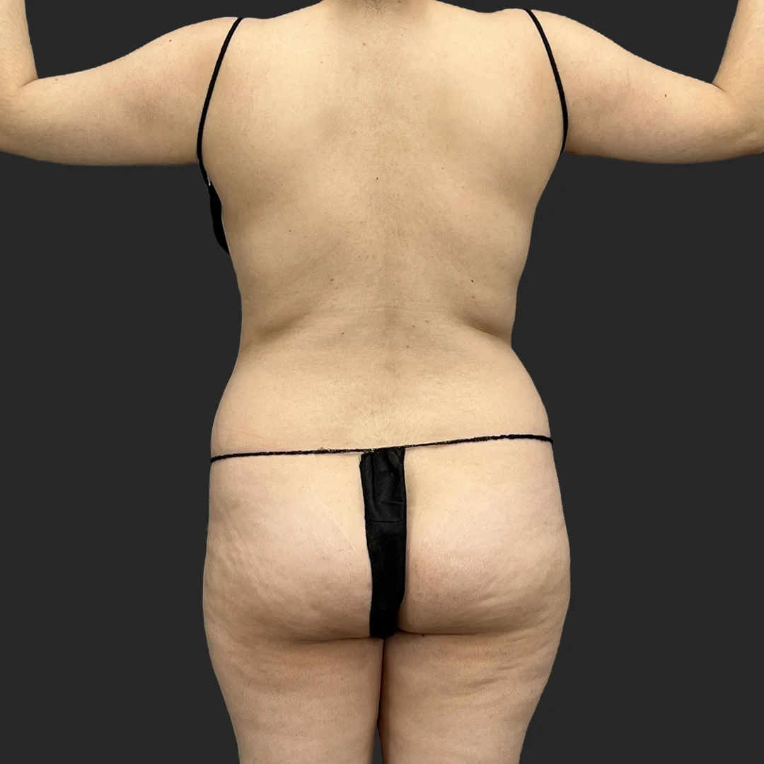 Procedure before and after - before