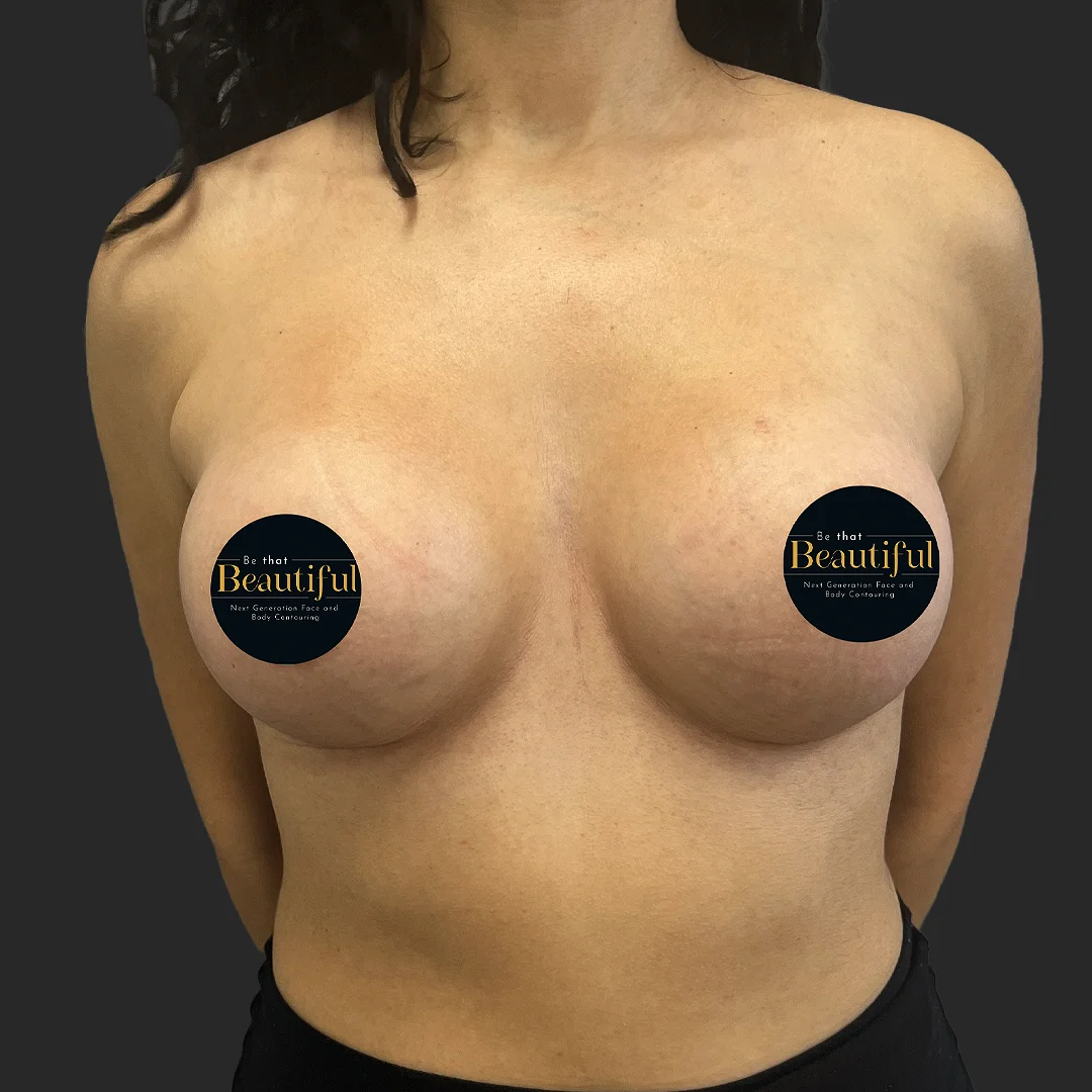 Procedure before and after - after
