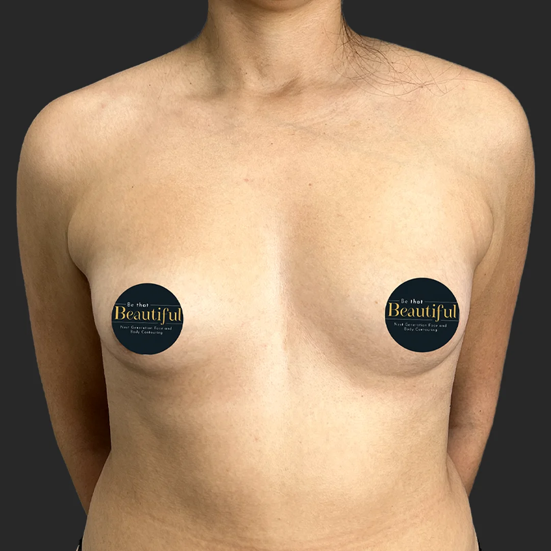 Procedure before and after - before