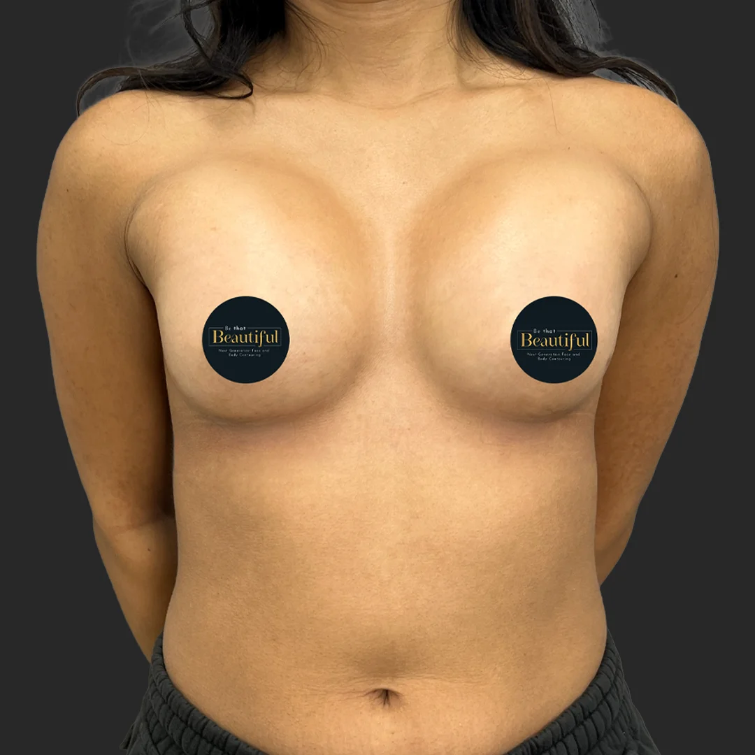 Procedure before and after - after