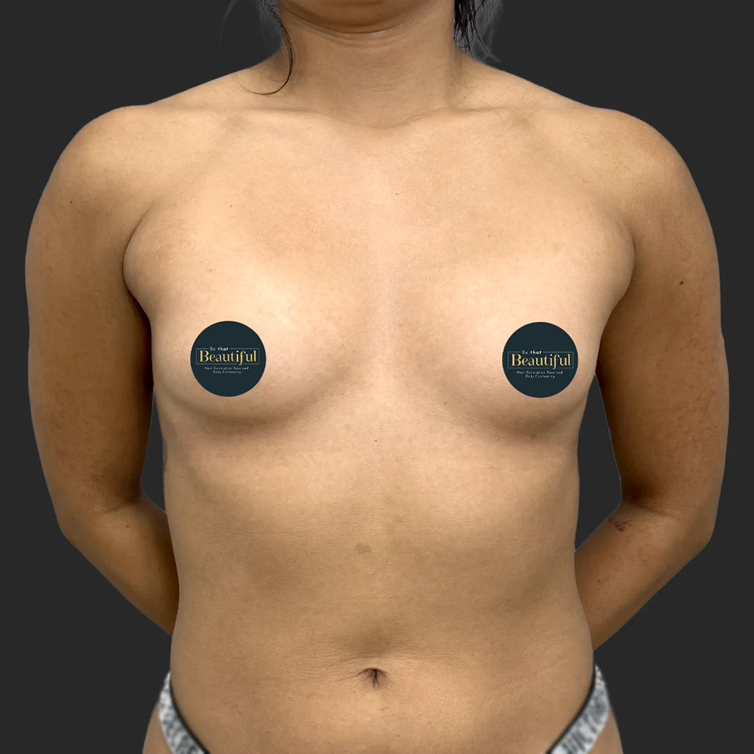 Procedure before and after - before