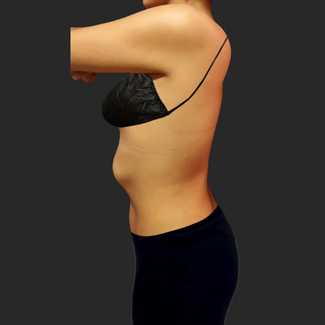Procedure before and after - before