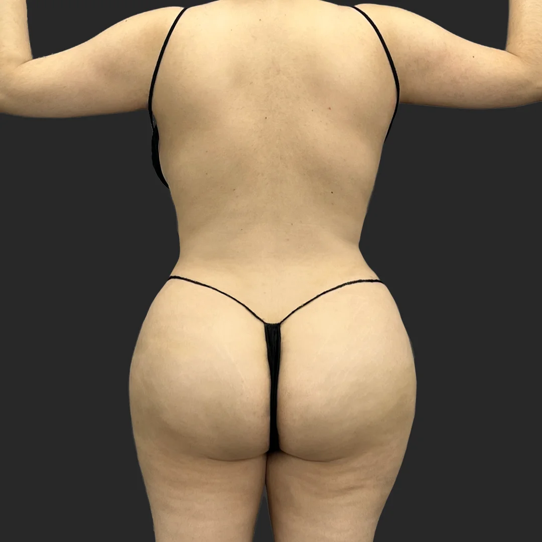 Procedure before and after - after