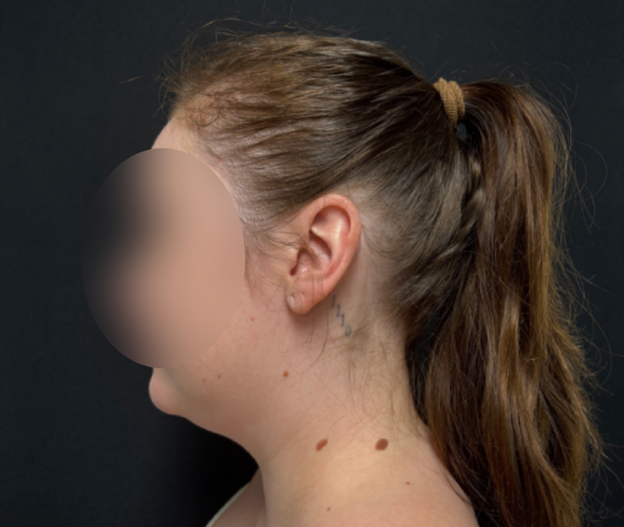 Procedure before and after - before