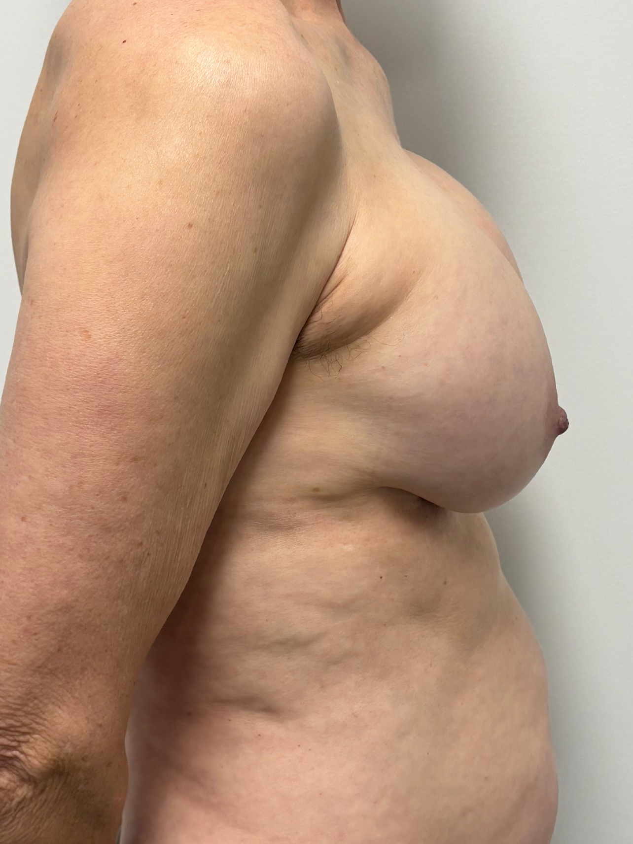 Procedure before and after - before