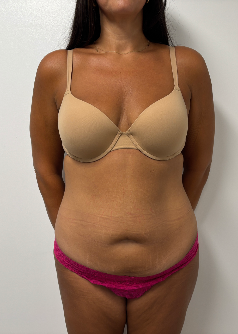 Procedure before and after - before