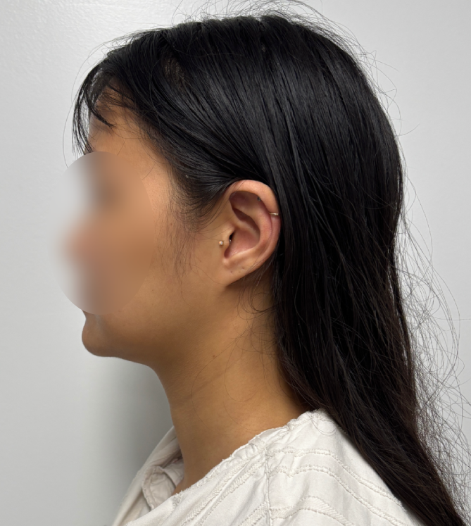 Procedure before and after - before