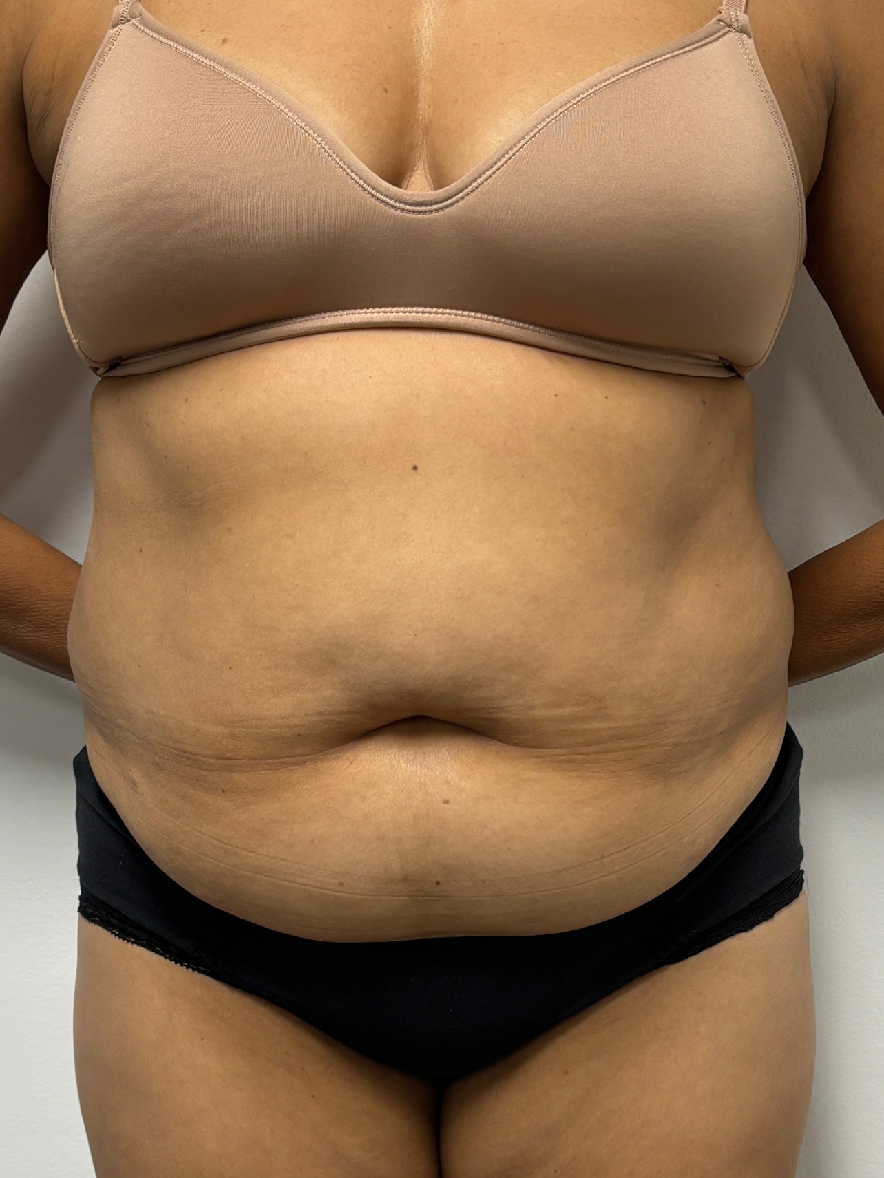 Procedure before and after - before