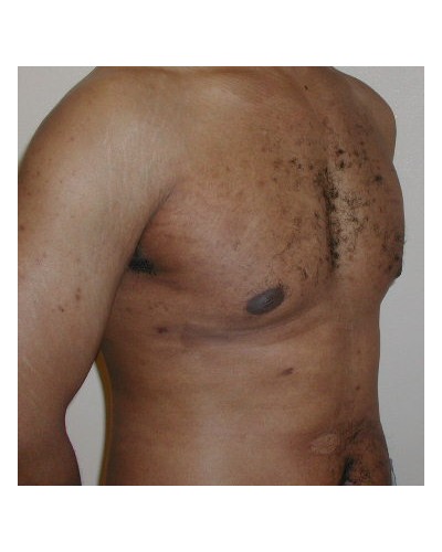 Procedure before and after - after