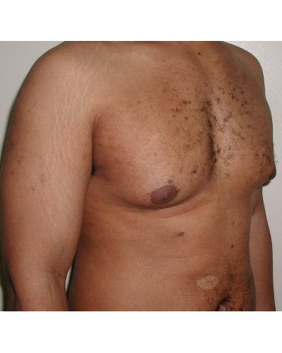 Procedure before and after - before