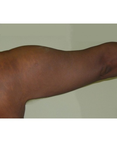 Procedure before and after - after
