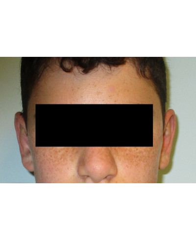 Procedure before and after - after