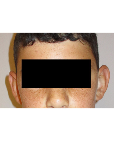 Procedure before and after - before