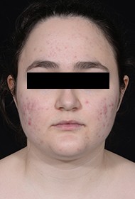 Procedure before and after - before
