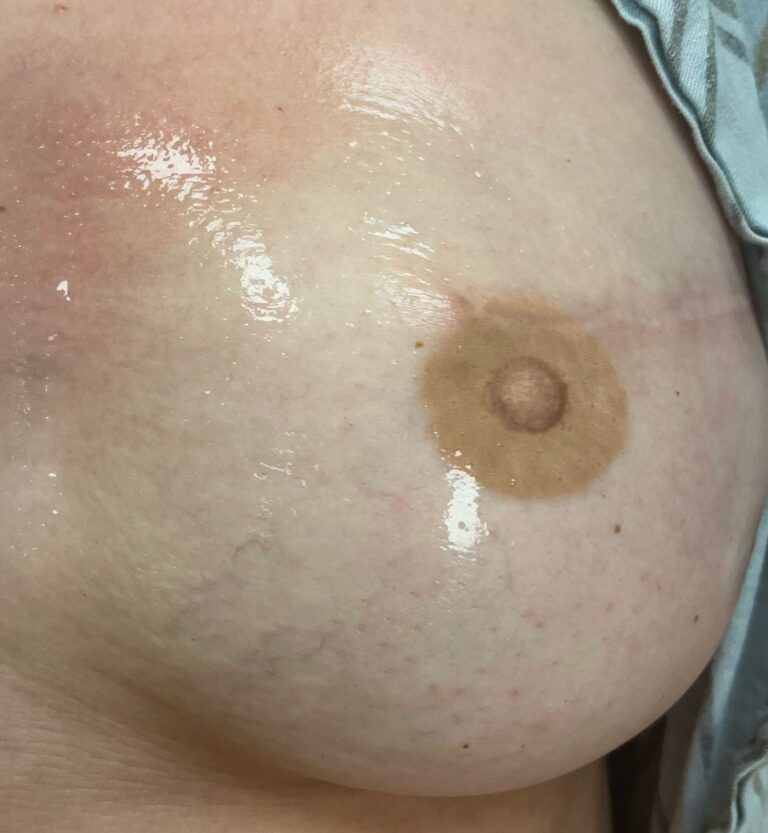 Nipple Tattooing before and after - after