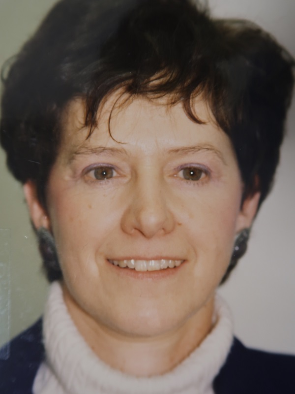 Facelift after — Dr. Enrique Armenta