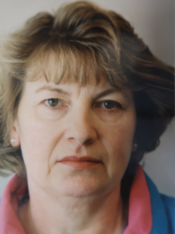 Facelift before and after - before