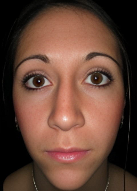 Procedure before and after - after