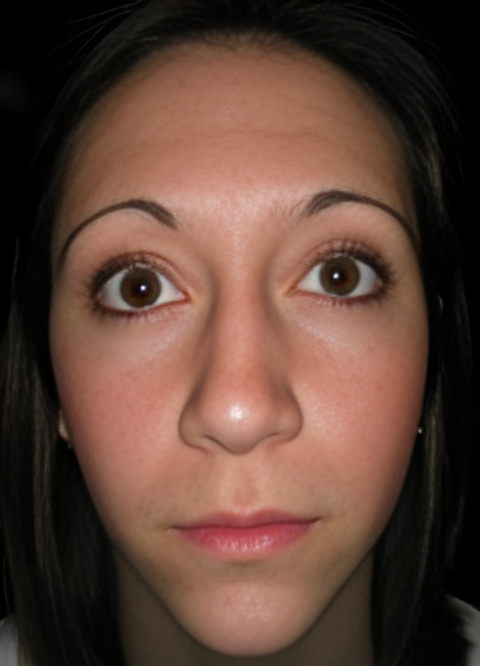 Procedure before and after - before