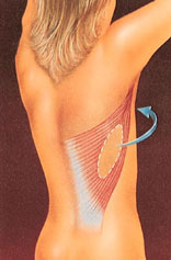 Breast Reconstruction before and after - after