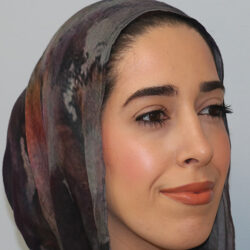 Rhinoplasty before and after - after