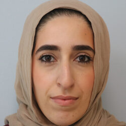 Rhinoplasty before and after - before