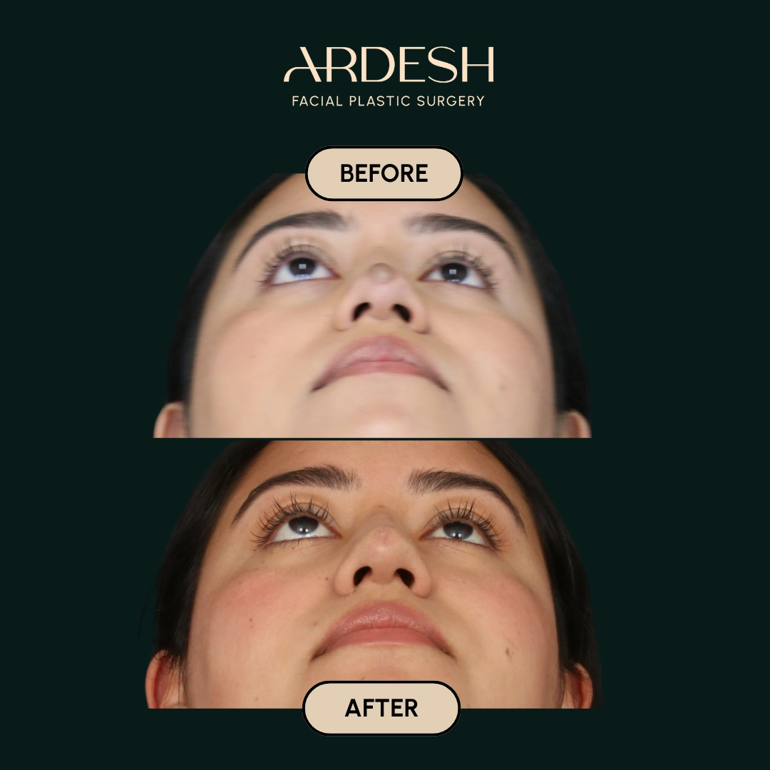 Procedure before and after - after