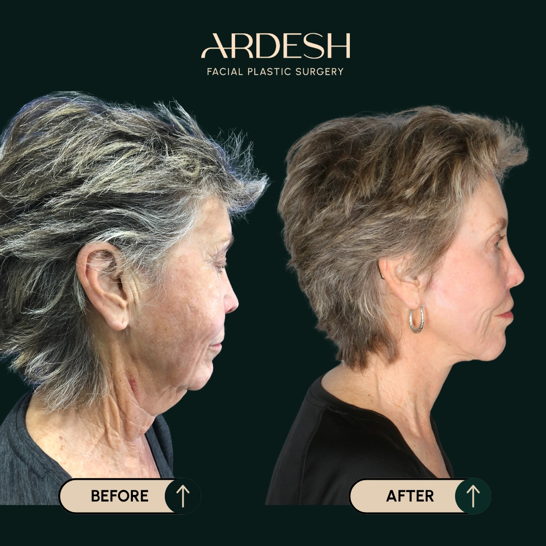 Other procedures by Dr. Farhad Ardeshirpour-Zartoshti — after