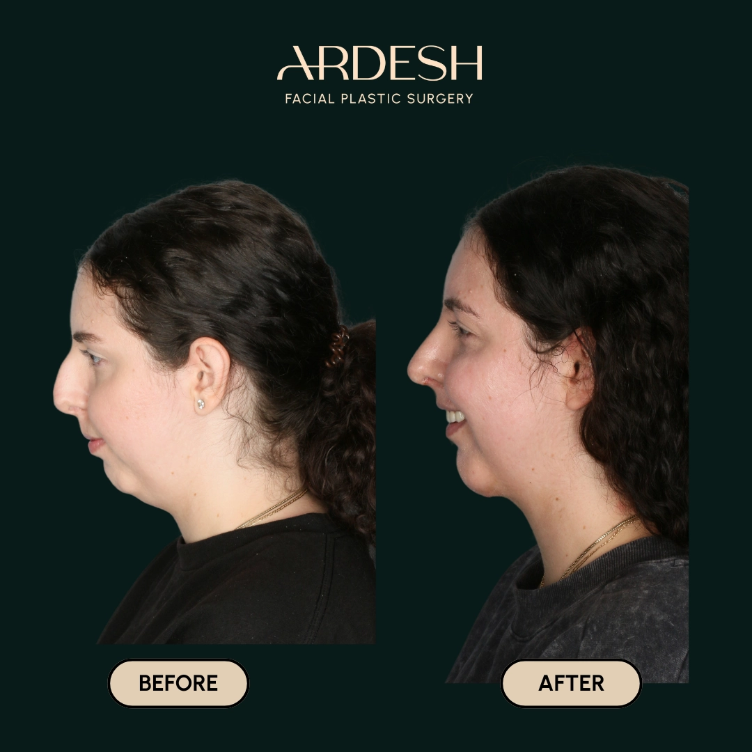 Procedure before and after - after