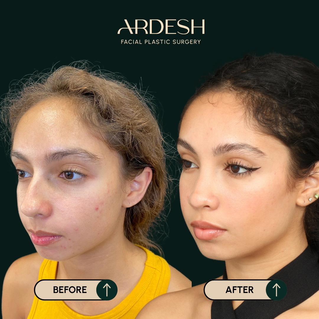Procedure before and after - after