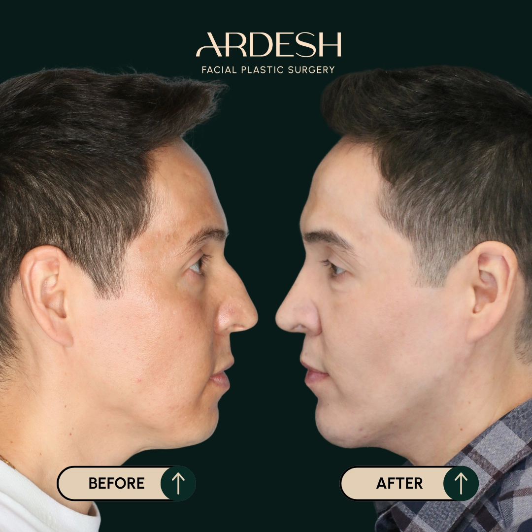 Procedure before and after - after