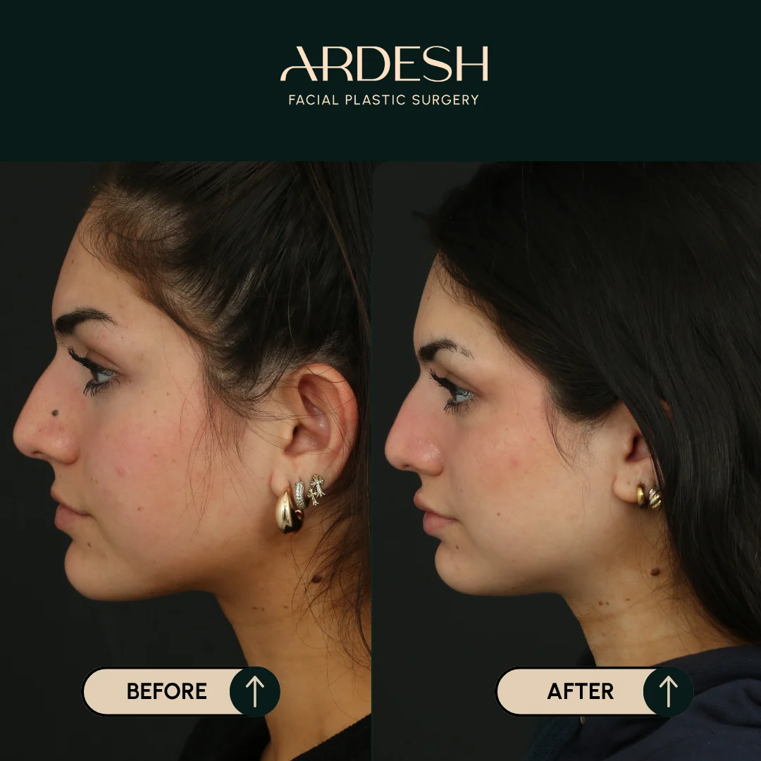 Procedure before and after - after