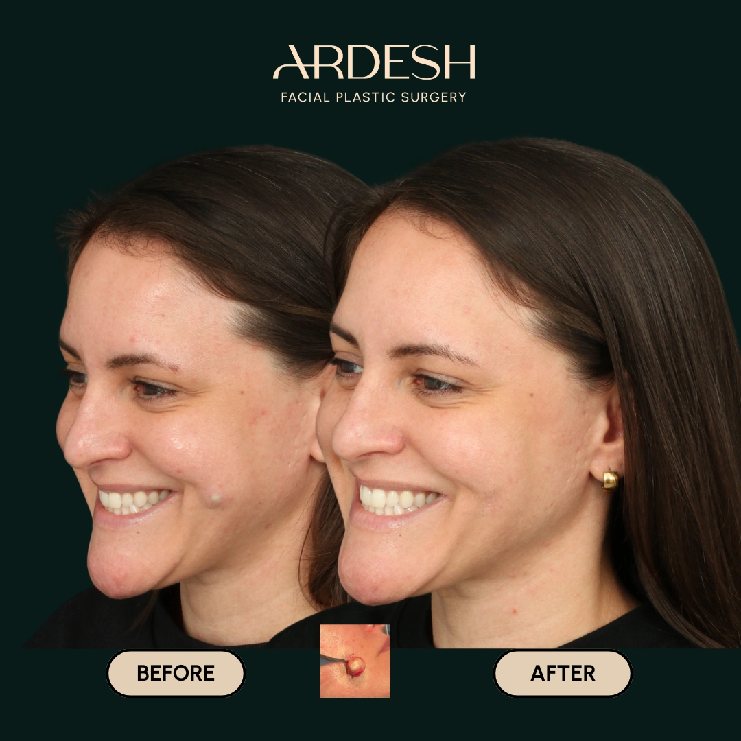 Procedure before and after - after