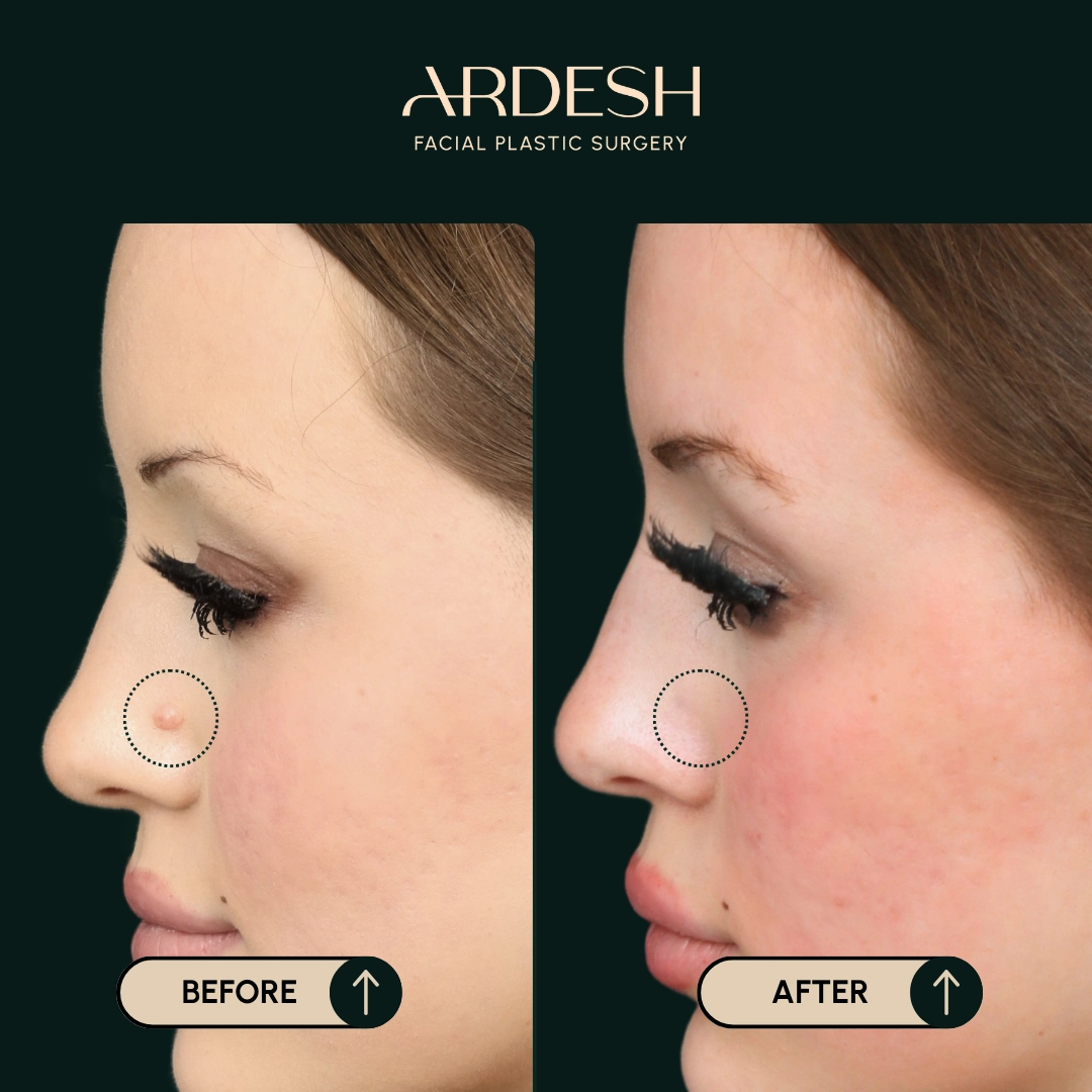 Procedure before and after - after