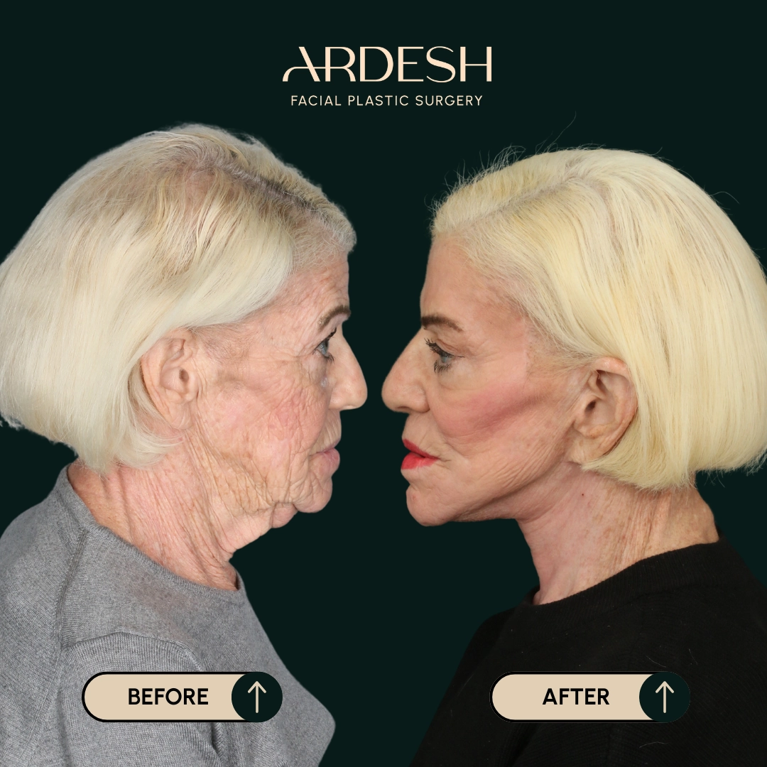 Procedure before and after - after