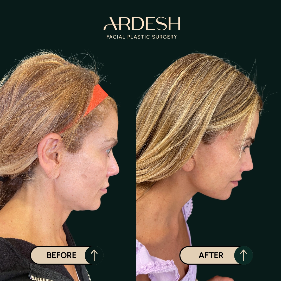 Other procedures by Dr. Farhad Ardeshirpour-Zartoshti — before