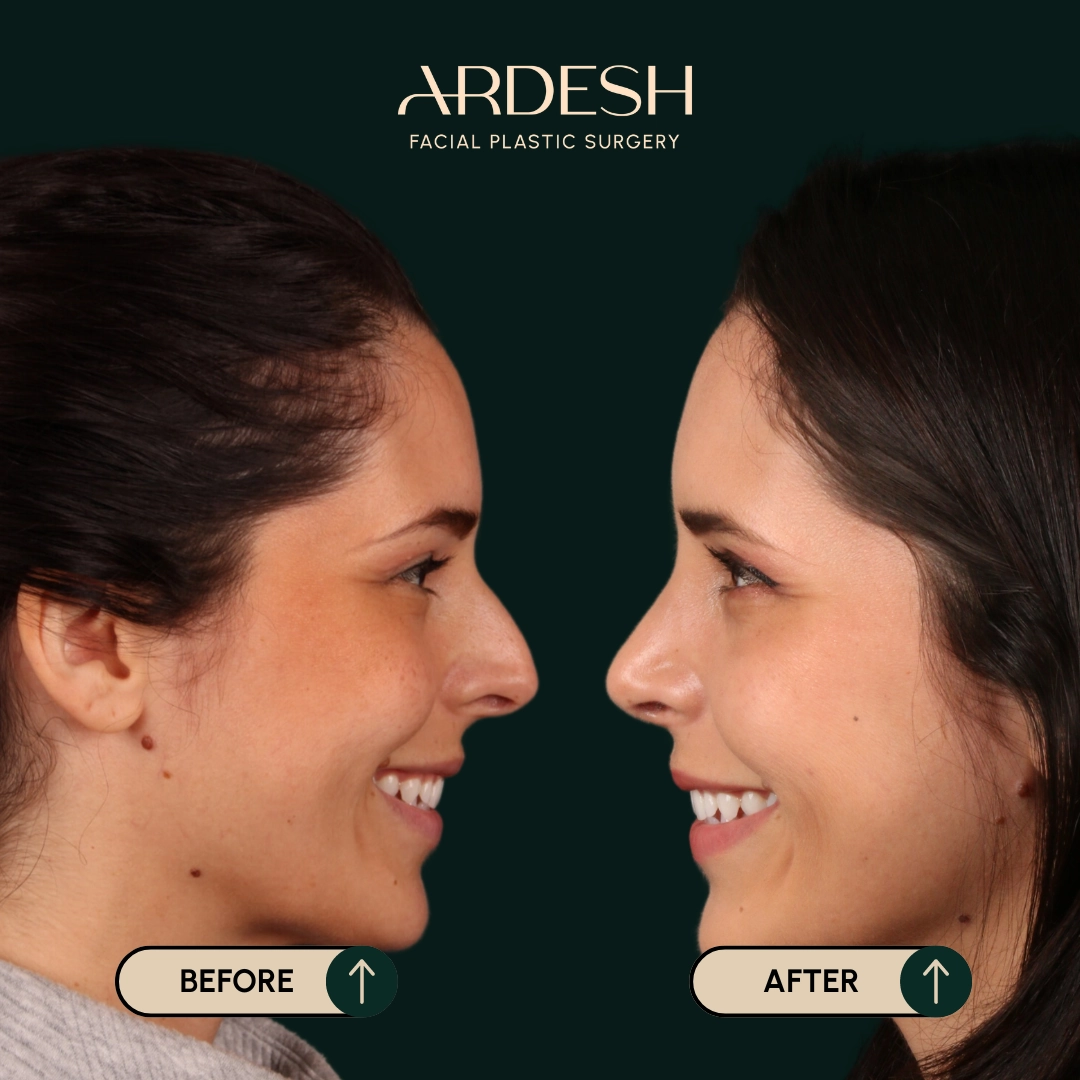 Other procedures by Dr. Farhad Ardeshirpour-Zartoshti — before and after