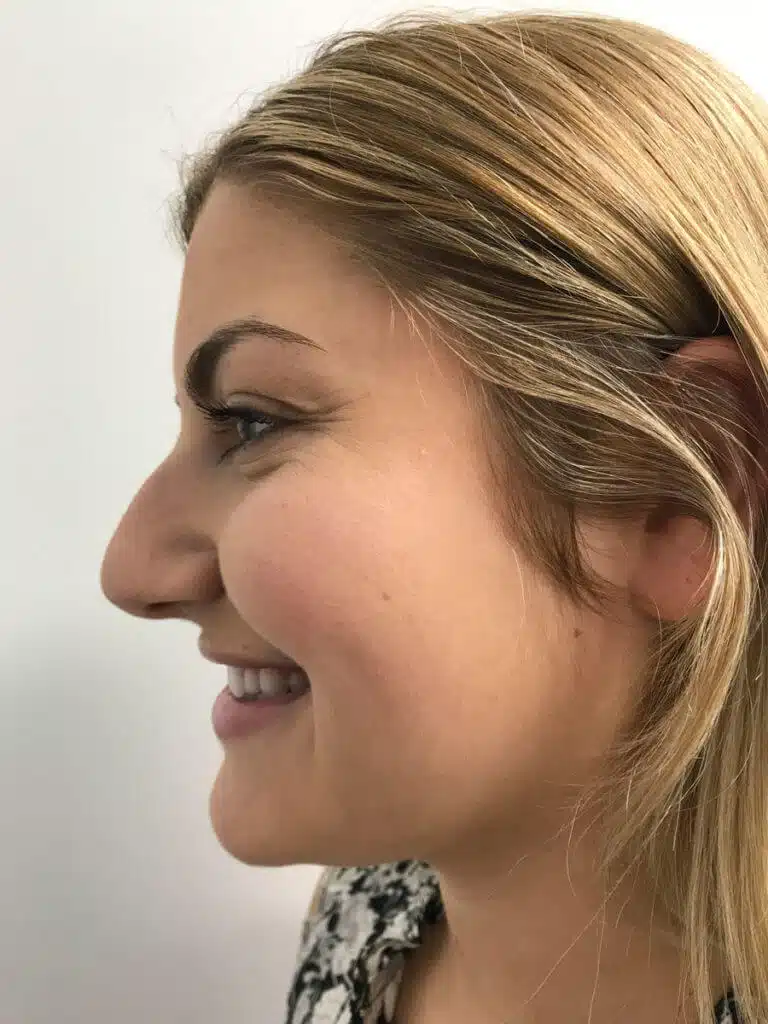 Procedure before and after - before