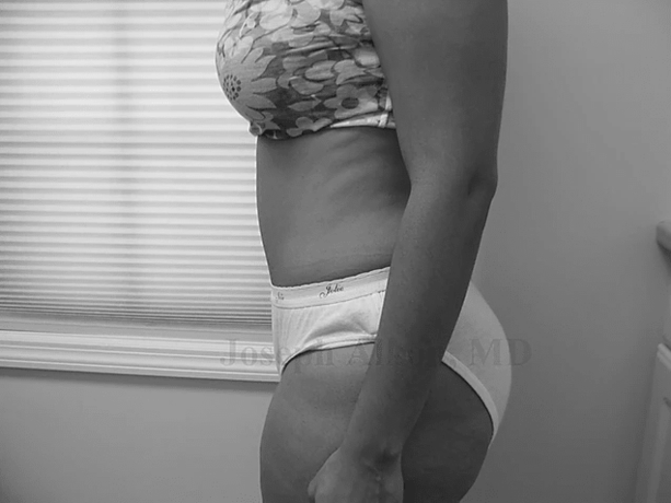 Procedure before and after - after