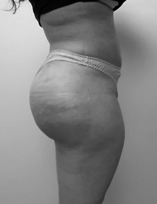 Procedure before and after - after