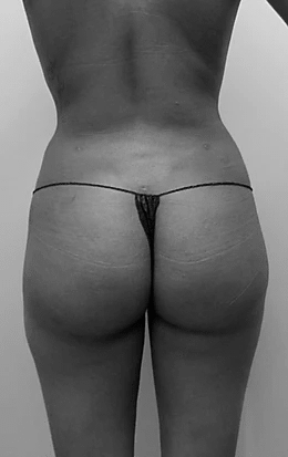 Procedure before and after - after