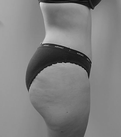 Procedure before and after - after